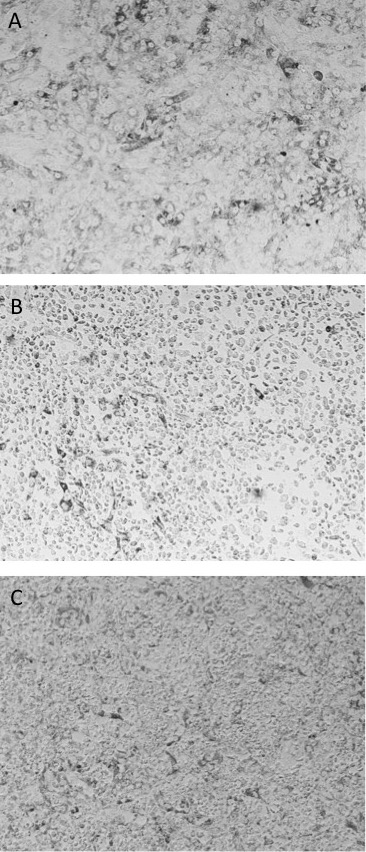 A) Vero cell monolayer compared to observed ctyopathic effects from undiluted supernatants of ADE assay in the presence of 4G2 antibody and B) Zika virus or C) dengue virus.