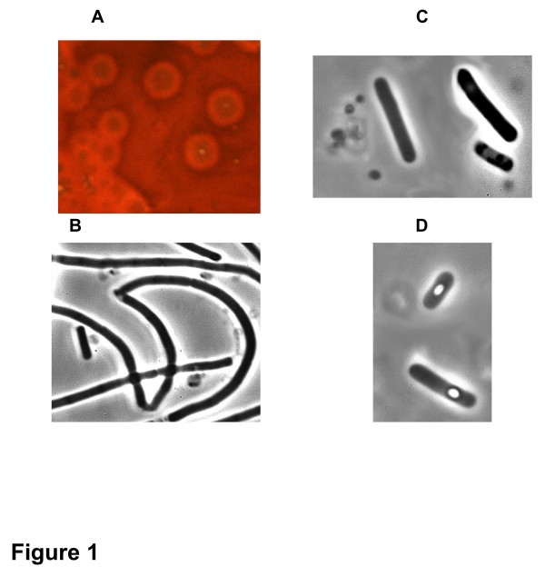 A, colonies on sheep blood TGY agar surrounded by hemolysis halo. Phase contrast microscopy (objective x100) of culture in TGY broth in the exponential growth phase (B), stationary phase (C), and sporulation phase (D).